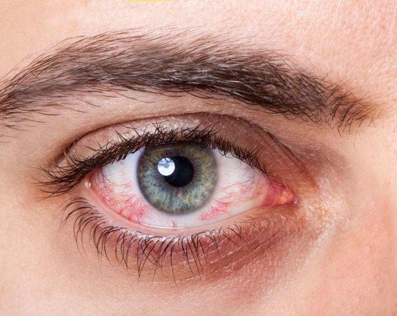 Samodzielne zdjęcia siatkówki oka dla pacjentów z retinopatią cukrzycową