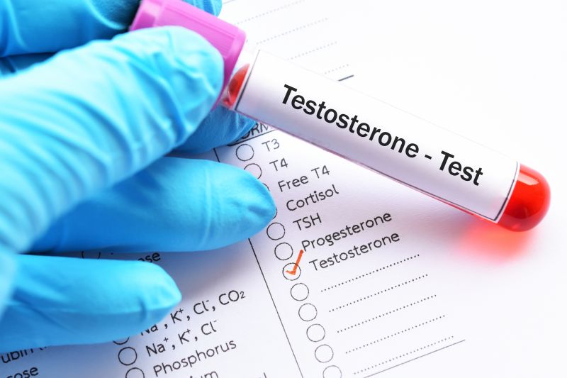Niedobór testosteronu – od jakiej wartości?