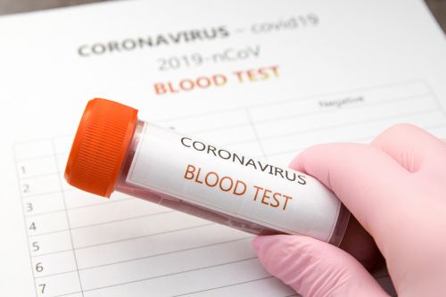 Mamy szybki i skuteczny test na koronawirusa